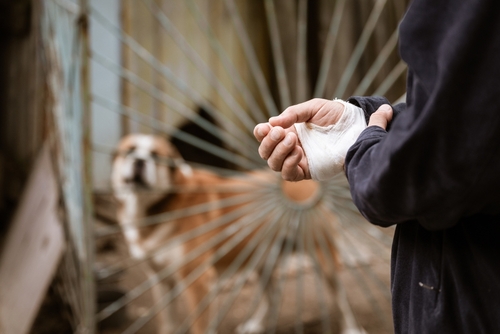 Can I Claim Compensation For a Dog Bite?